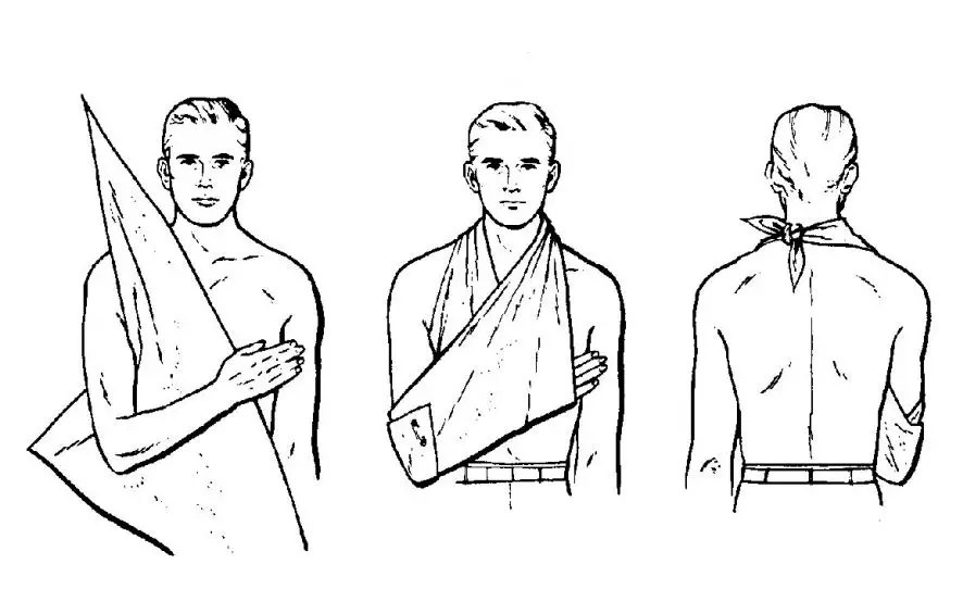 how to make an arm sling with a triangular bandage - method 1