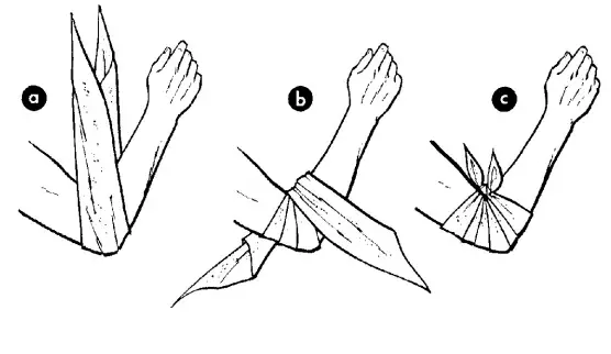 triangle bandage - elbow dressing