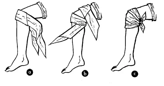 triangle bandage - knee dressing