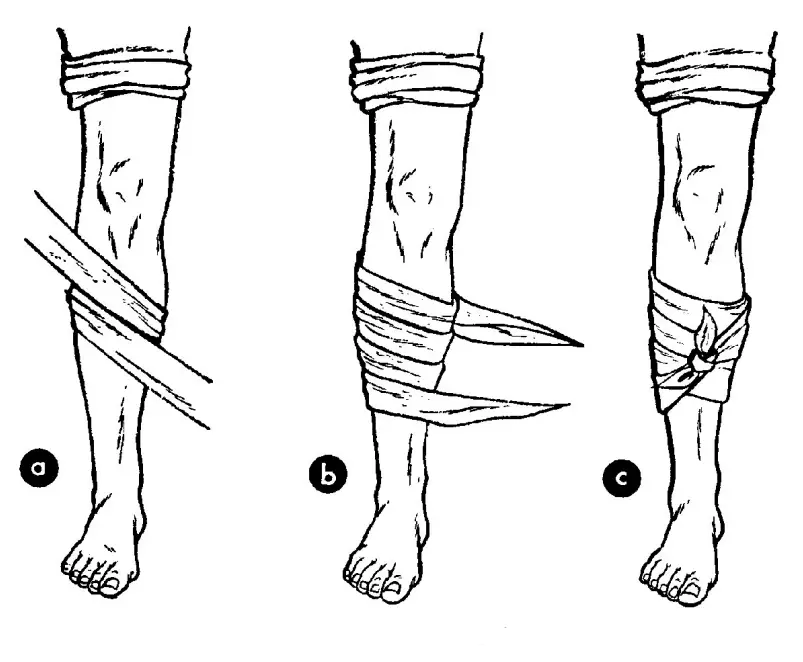 triangle bandage - limb dressing