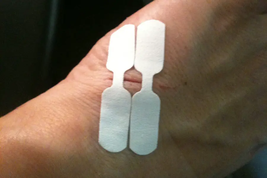 butterfly bandages of a cut
